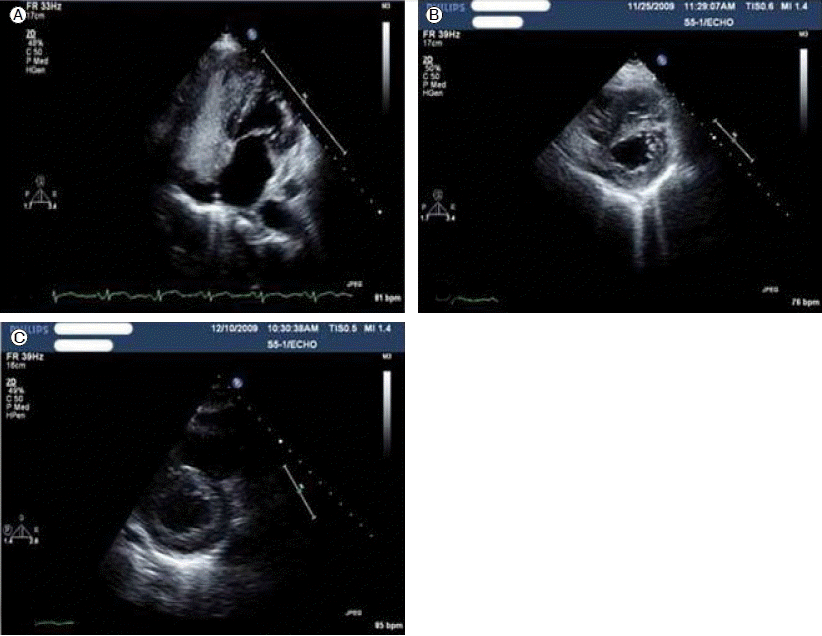 download laser surgery for the management of ent malignancies: