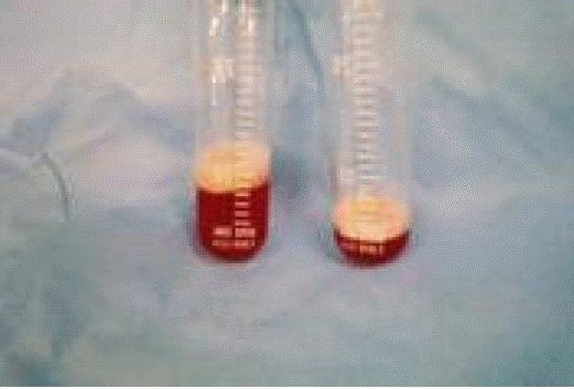 kjm-79-4-428-15f2.gif