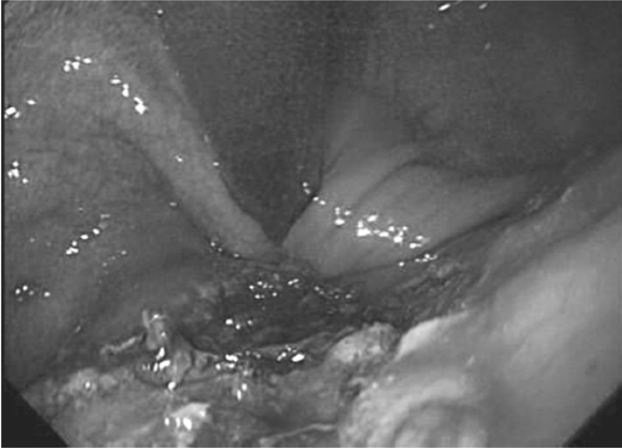 kjm-80-1-78-13f5.gif