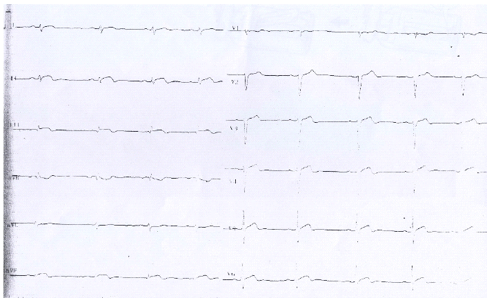 kjm-80-1-92-16f2.gif