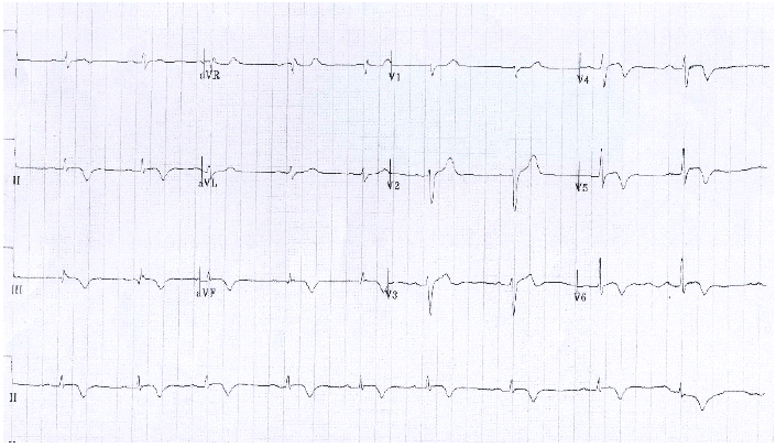 kjm-80-1-92-16f3.gif