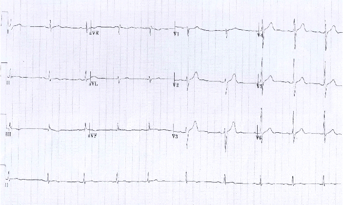 kjm-80-1-92-16f4.gif