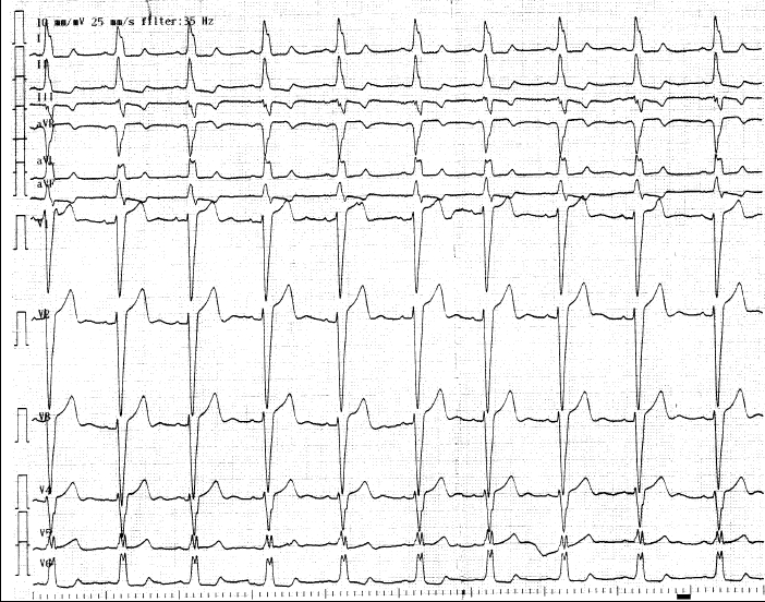 kjm-80-3-333-15f1.gif