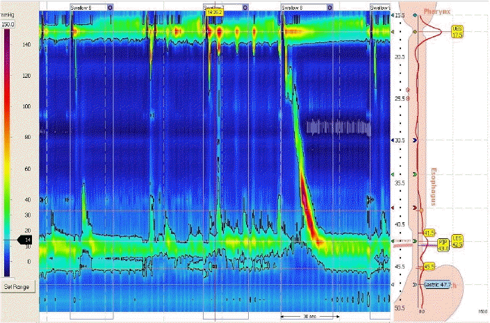 kjm-81-2-223-14f3.gif