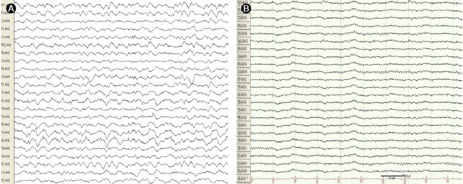 kjm-82-3-382-24f2.gif