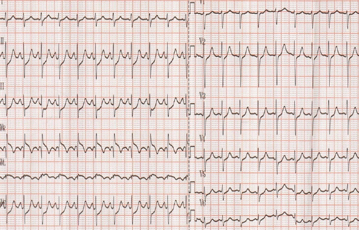 kjm-82-6-724-15f1.gif