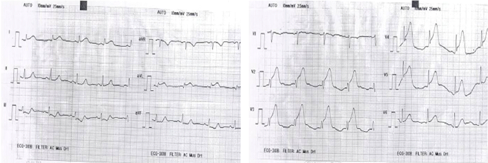 kjm-83-1-101-14f1.gif