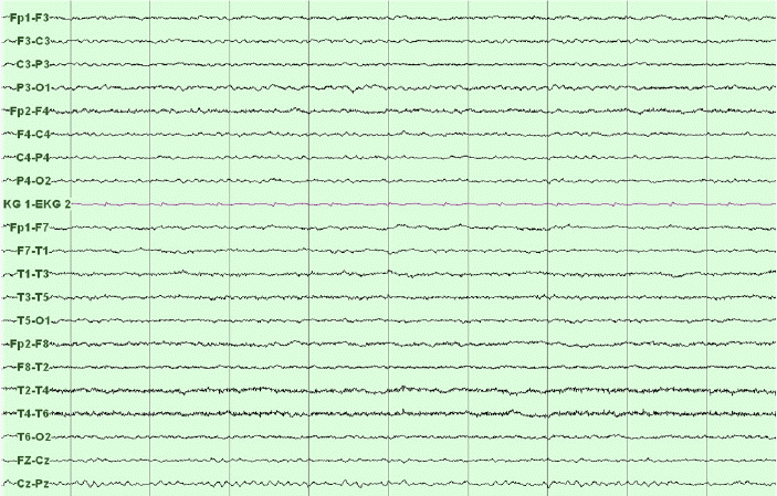 kjm-83-5-679-23f1.gif