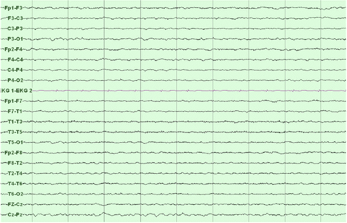 kjm-83-5-679-23f2.gif