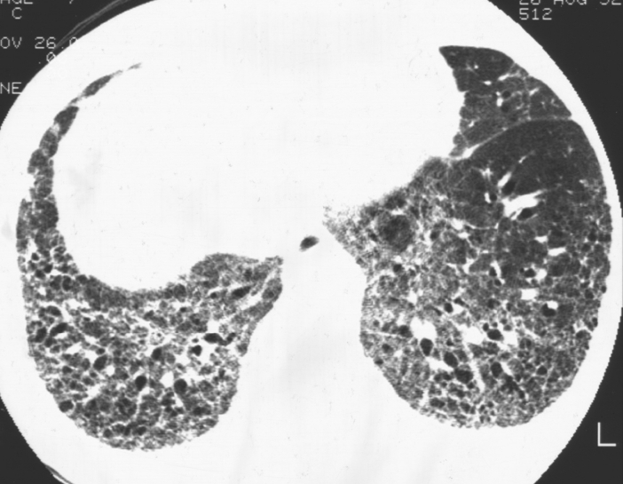 kjm-84-4-489-2f11.gif