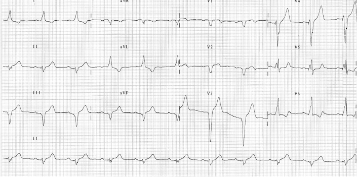 kjm-85-6-619-13f2.gif