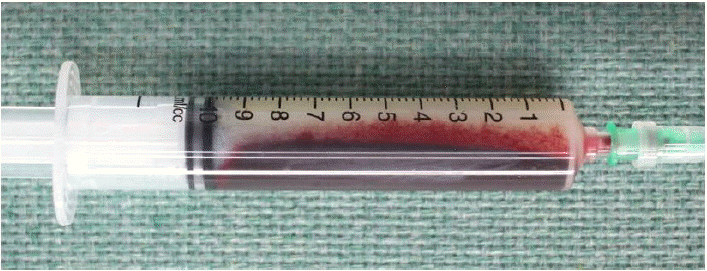 kjm-85-6-634-16f2.gif