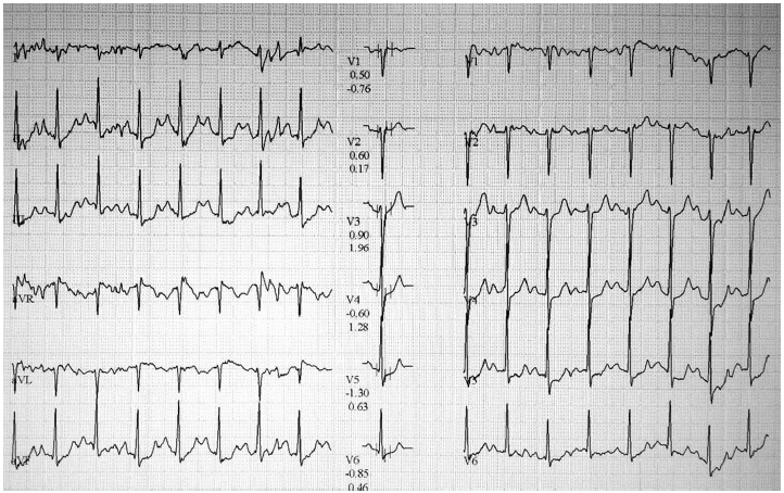kjm-89-4-448f1.gif
