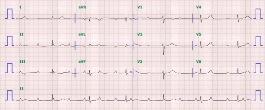 kjm-90-5-440f1.gif