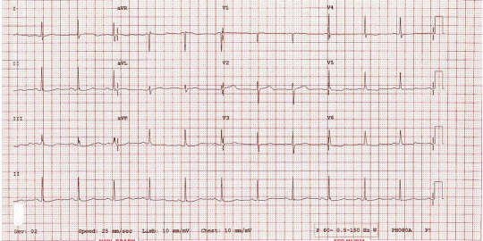 kjm-90-5-444f2.gif