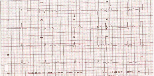 kjm-90-5-444f3.gif