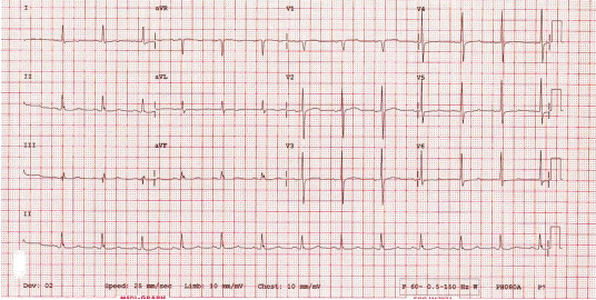 kjm-90-5-444f4.gif