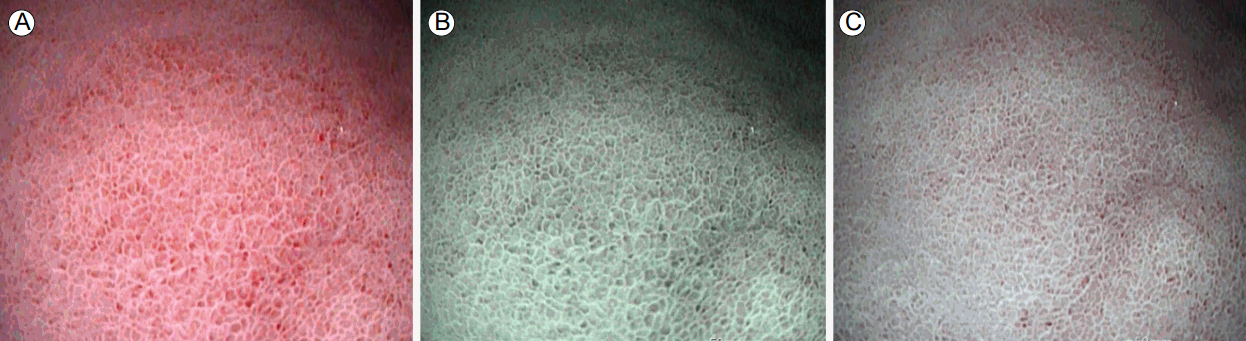 kjm-92-3-264f4.gif
