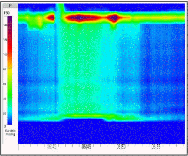 kjm-93-4-360f1.tif